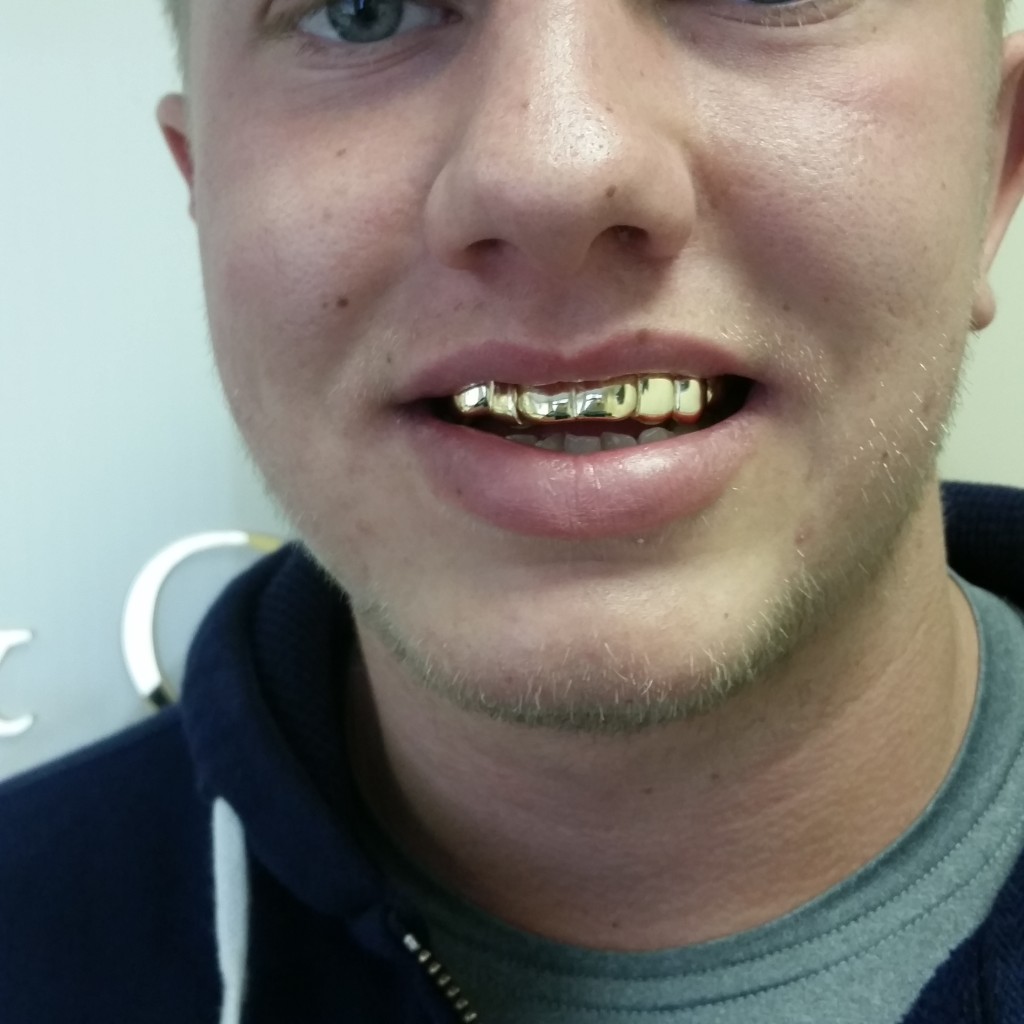18 ct Real Gold Grillz