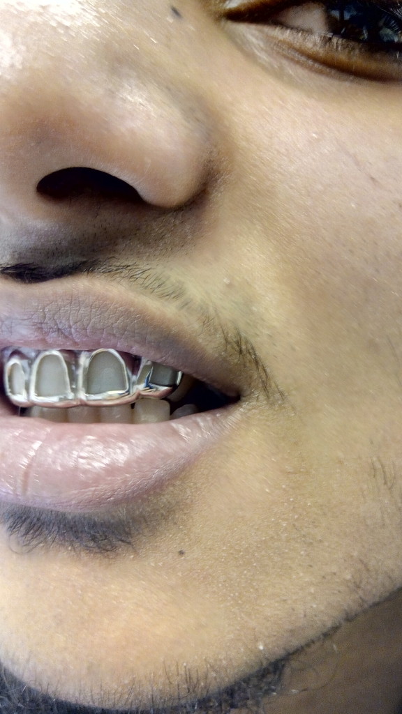 18 ct Real Gold Grillz